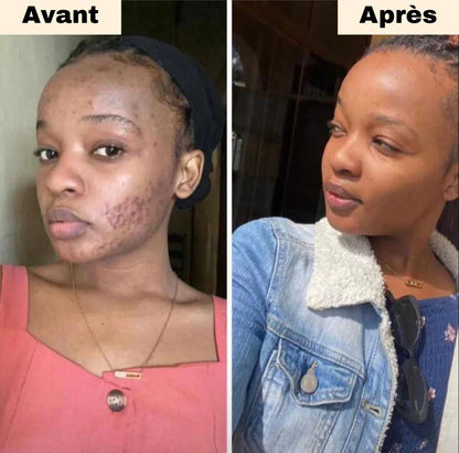 Cotons au Curcuma Anti-Imperfections(60 Pads)