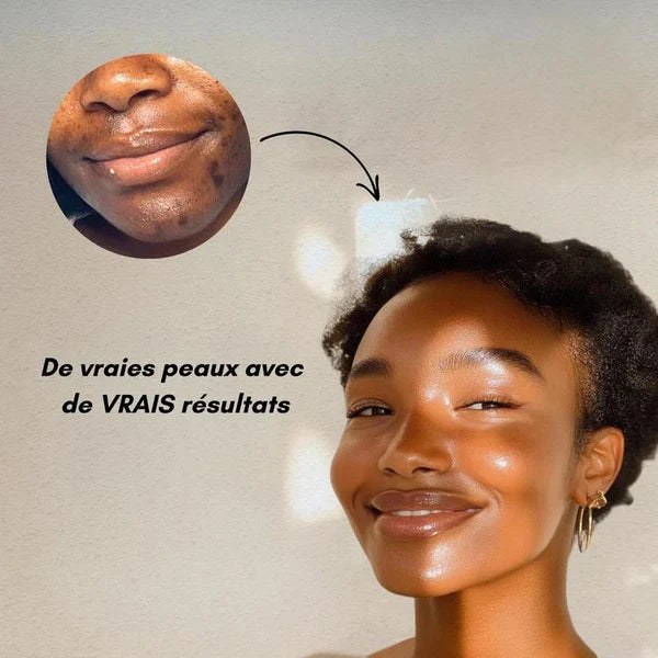 Cotons au Curcuma Anti-Imperfections(60 Pads)