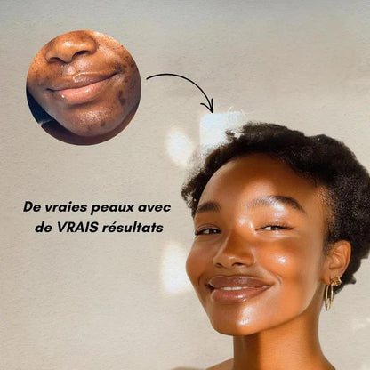 Cotons au Curcuma Anti-Imperfections(60 Pads)